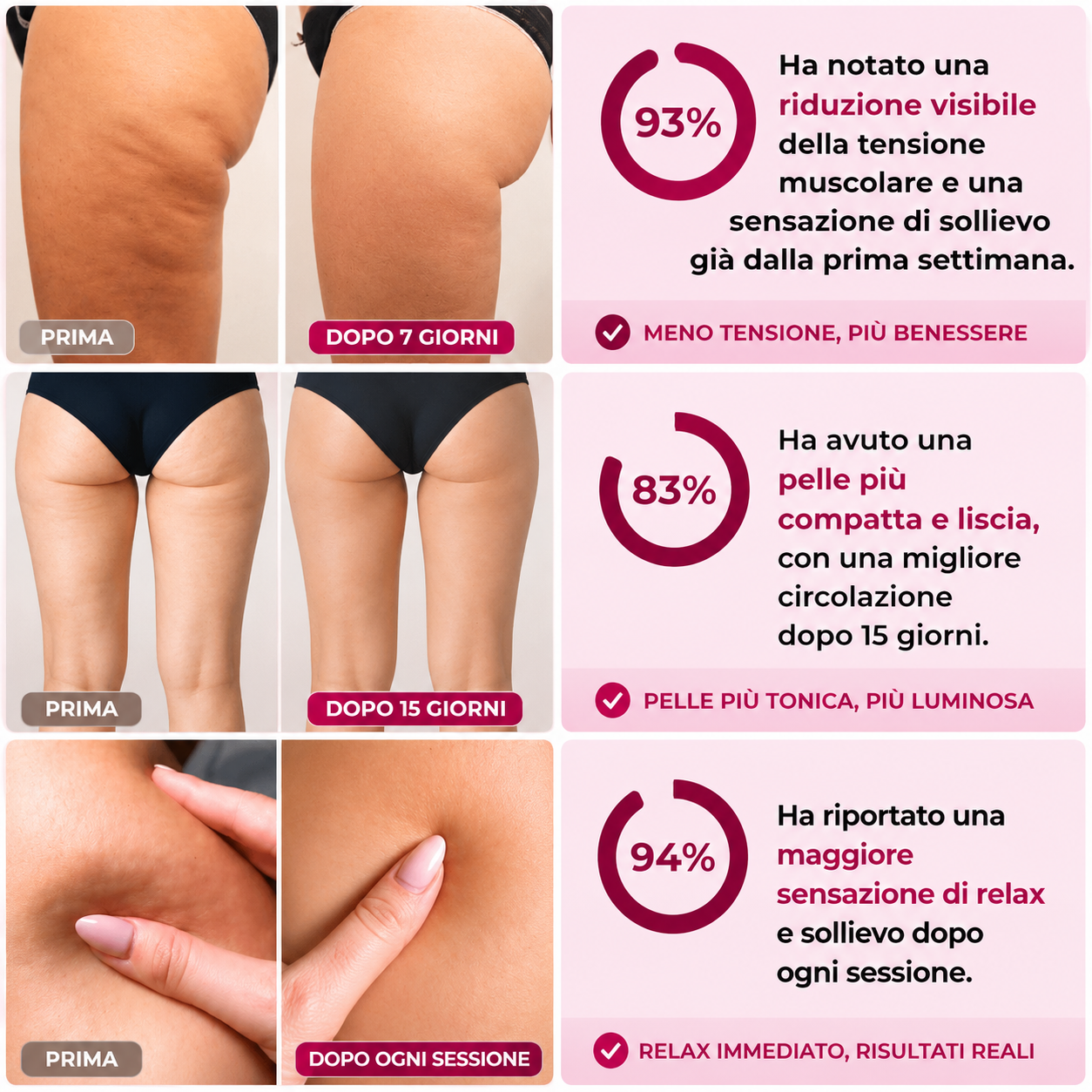 CelluLift Pro™- Rimuovi Cellulite di Legious
