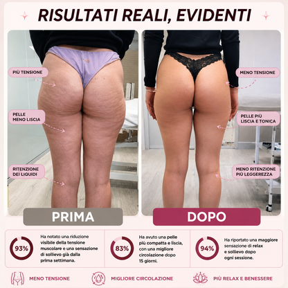 CelluLift Pro™- Rimuovi Cellulite di Legious